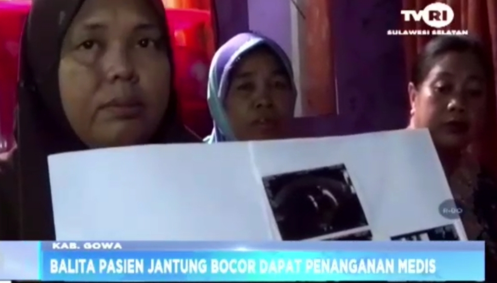 Gubernur Andi Sudirman Intsruksikan Balita Jantung Bocor Di Gowa Dapar Penanganan Intensif